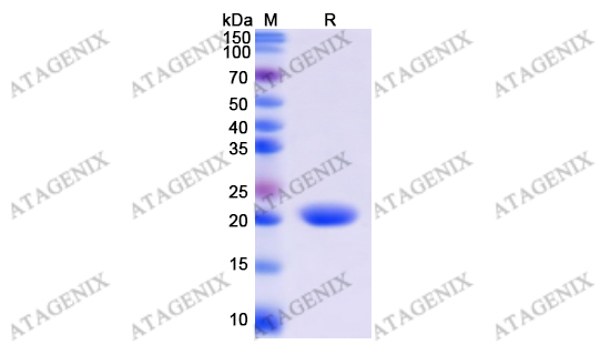 Recombinant Human CPN1, N-His价格_Recombinant Human CPN1, N-His厂家-武汉普健生物