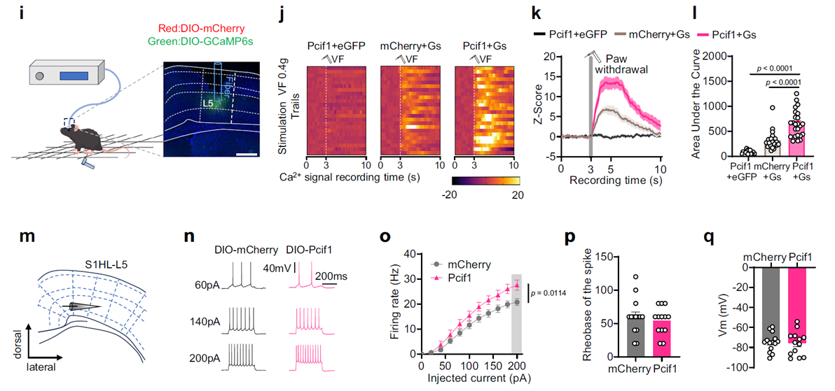 PCIF1 upregulation directly drives abnormal excitation in the pain circuitry