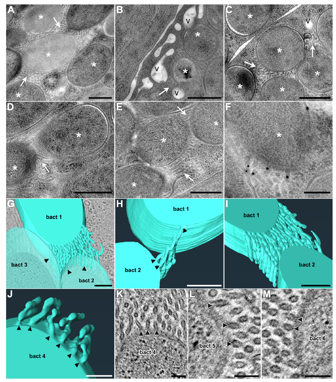 Endosymbionts generate abundant tubular membrane extensions inside bacterial cells