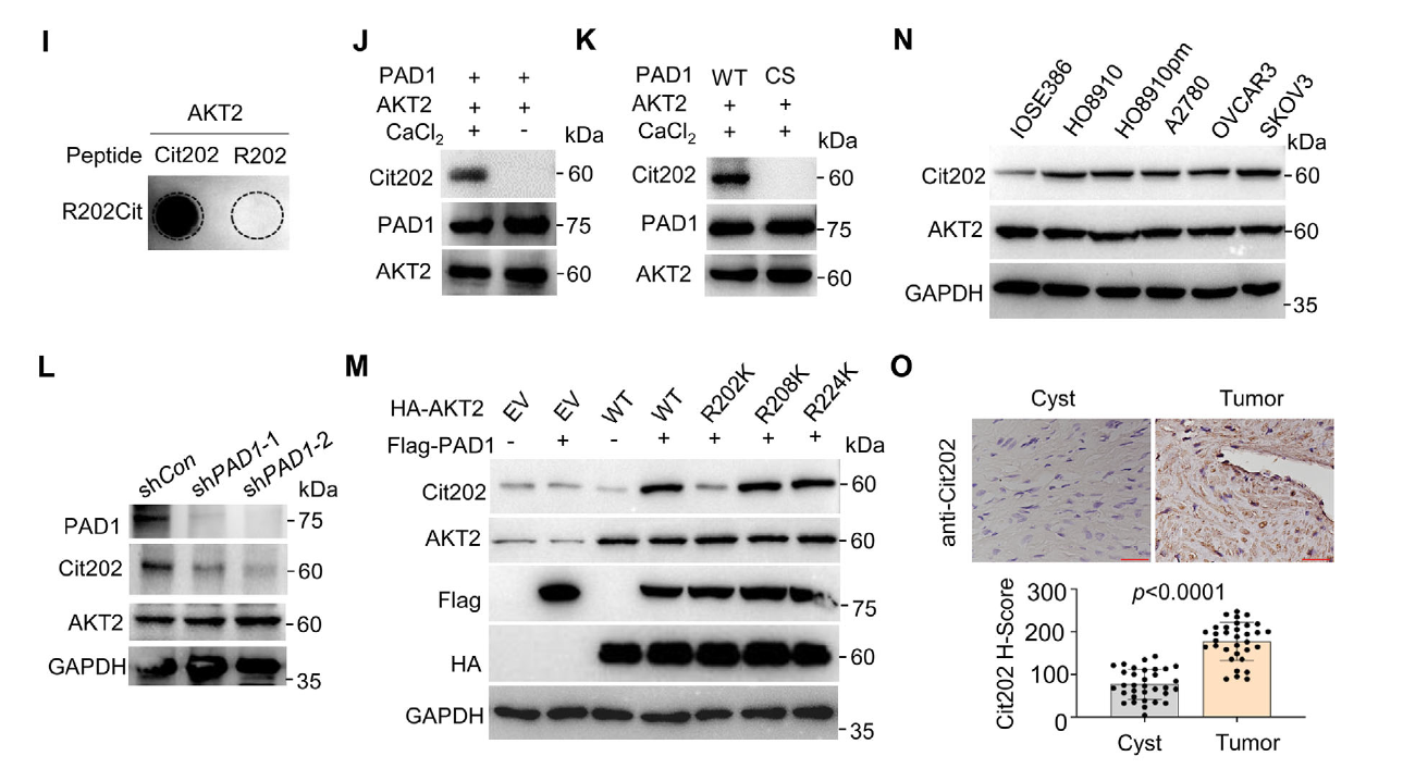 AtaGenix Cit202 antibody detection results showing AKT2 R202 citrullination in ovarian cancer cells