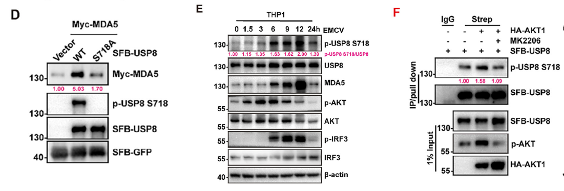 Western blot detection of USP8 Ser718 phosphorylation using AtaGenix custom phospho-antibody
