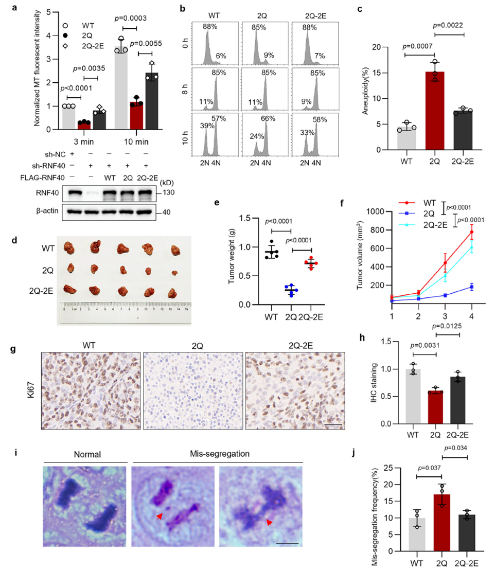 Crosstalk between RNF40 acetylation and phosphorylation affects tumor growth